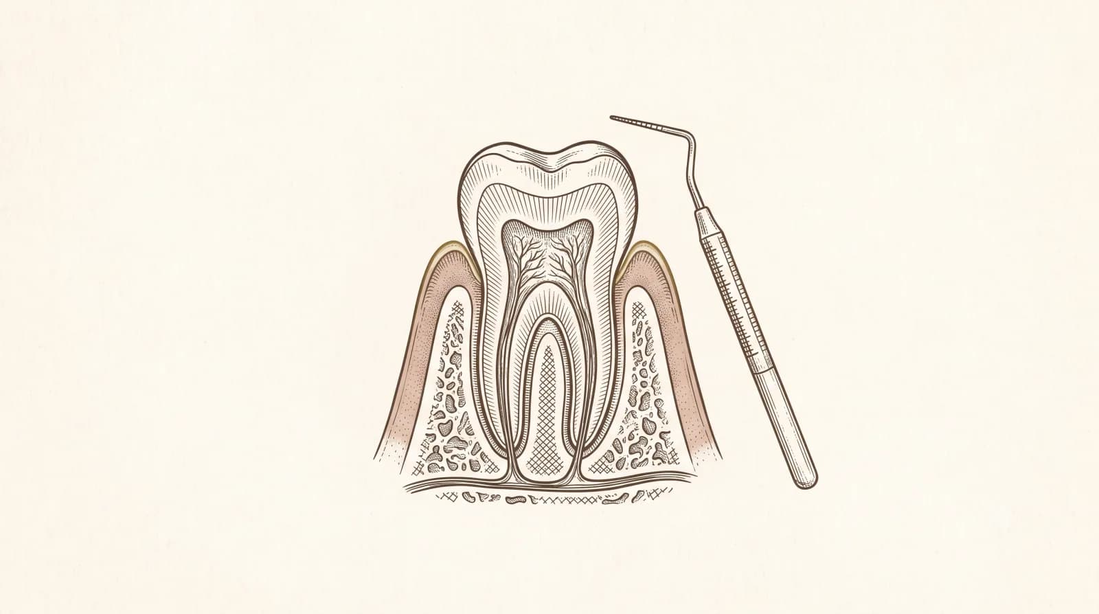 Periodontoloji illüstrasyonu — diş eti ve çene kemiği içindeki diş kesiti, yanında periodontal sond